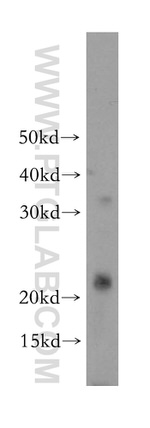 PPP1R14B Antibody in Western Blot (WB)