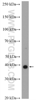 HOXA9 Antibody in Western Blot (WB)