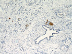 Cytokeratin 17 Antibody in Immunohistochemistry (Paraffin) (IHC (P))