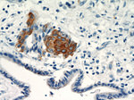 Cytokeratin 17 Antibody in Immunohistochemistry (Paraffin) (IHC (P))