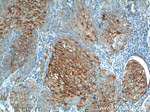 Cytokeratin 17 Antibody in Immunohistochemistry (Paraffin) (IHC (P))
