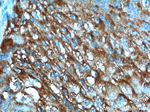 Cytokeratin 17 Antibody in Immunohistochemistry (Paraffin) (IHC (P))
