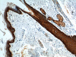 Cytokeratin 17 Antibody in Immunohistochemistry (Paraffin) (IHC (P))