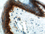 Cytokeratin 17 Antibody in Immunohistochemistry (Paraffin) (IHC (P))