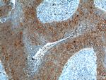 Cytokeratin 17 Antibody in Immunohistochemistry (Paraffin) (IHC (P))