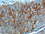 Cytokeratin 17 Antibody in Immunohistochemistry (Paraffin) (IHC (P))