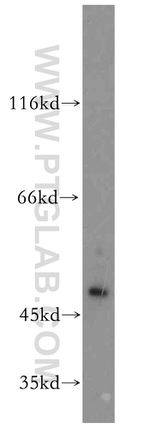 Cytokeratin 17 Antibody in Western Blot (WB)