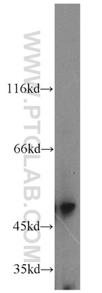 GAL3ST1 Antibody in Western Blot (WB)