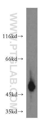 GAL3ST1 Antibody in Western Blot (WB)