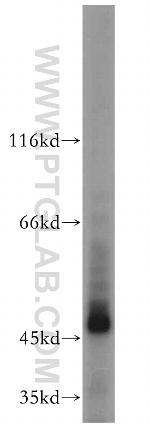 GAL3ST1 Antibody in Western Blot (WB)