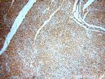 SH2D2A Antibody in Immunohistochemistry (Paraffin) (IHC (P))