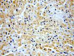 SH2D2A Antibody in Immunohistochemistry (Paraffin) (IHC (P))