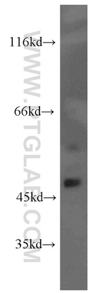 SH2D2A Antibody in Western Blot (WB)