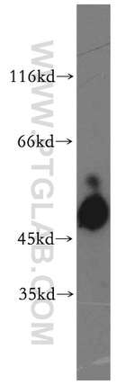 SH2D2A Antibody in Western Blot (WB)