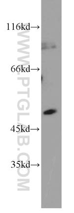 SH2D2A Antibody in Western Blot (WB)