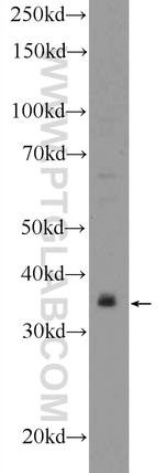 DNAJB7 Antibody in Western Blot (WB)