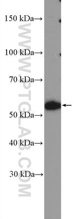 NAB1 Antibody in Western Blot (WB)