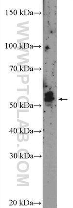 NAB1 Antibody in Western Blot (WB)