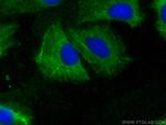 PDLIM4 Antibody in Immunocytochemistry (ICC/IF)
