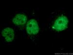 CBX4 Antibody in Immunocytochemistry (ICC/IF)