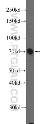 CBX4 Antibody in Western Blot (WB)