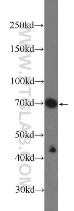 CBX4 Antibody in Western Blot (WB)