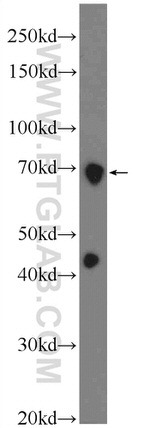 CBX4 Antibody in Western Blot (WB)