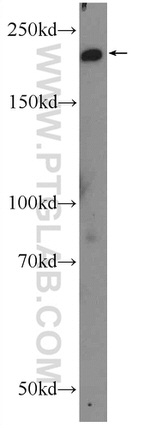 SMMHC Antibody in Western Blot (WB)