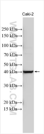 QPCT Antibody in Western Blot (WB)