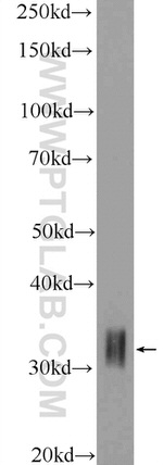 HOXD8 Antibody in Western Blot (WB)