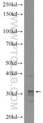 HOXD8 Antibody in Western Blot (WB)