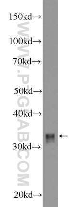 HOXD8 Antibody in Western Blot (WB)