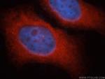 iASPP Antibody in Immunocytochemistry (ICC/IF)