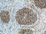 CD23 Antibody in Immunohistochemistry (Paraffin) (IHC (P))