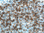 CD23 Antibody in Immunohistochemistry (Paraffin) (IHC (P))