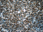 CD23 Antibody in Immunohistochemistry (Paraffin) (IHC (P))