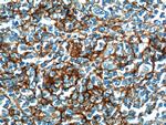 CD23 Antibody in Immunohistochemistry (Paraffin) (IHC (P))