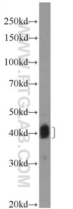 CD23 Antibody in Western Blot (WB)