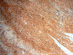 NR5A1 Antibody in Immunohistochemistry (Paraffin) (IHC (P))