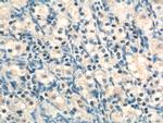 NR5A1 Antibody in Immunohistochemistry (Paraffin) (IHC (P))