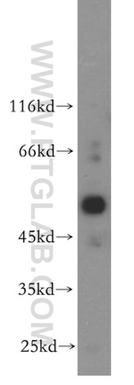 NR5A1 Antibody in Western Blot (WB)