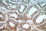 FUT10 Antibody in Immunohistochemistry (Paraffin) (IHC (P))
