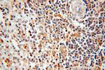 TSPAN7 Antibody in Immunohistochemistry (Paraffin) (IHC (P))