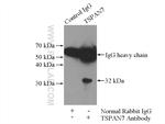 TSPAN7 Antibody in Immunoprecipitation (IP)