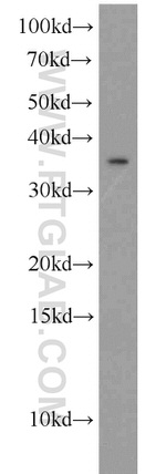 TSPAN7 Antibody in Western Blot (WB)