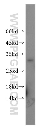TSPAN7 Antibody in Western Blot (WB)