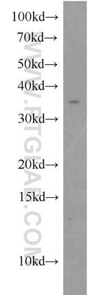 TSPAN7 Antibody in Western Blot (WB)