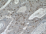 c-Kit/CD117 Antibody in Immunohistochemistry (Paraffin) (IHC (P))
