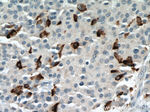 c-Kit/CD117 Antibody in Immunohistochemistry (Paraffin) (IHC (P))