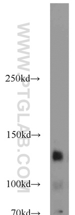 c-Kit/CD117 Antibody in Western Blot (WB)